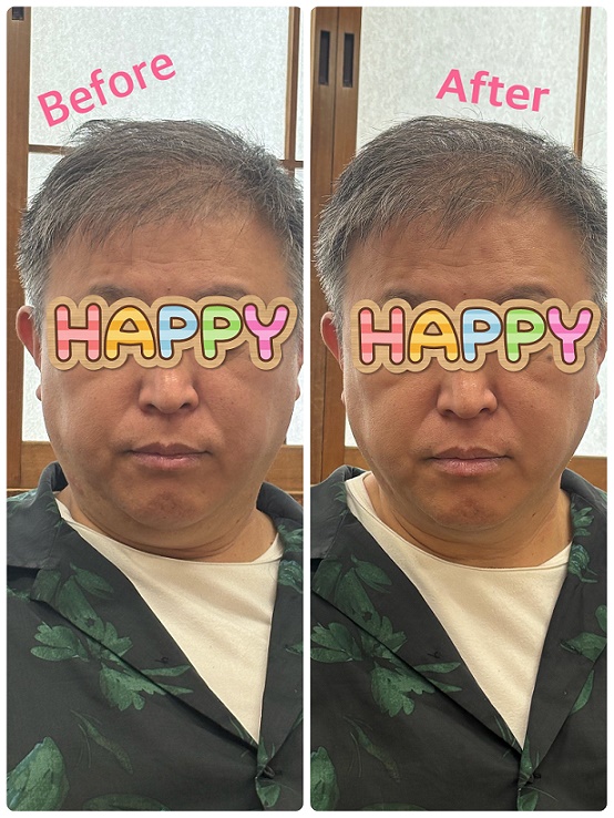 ̂݉PE烈KbX(S1)