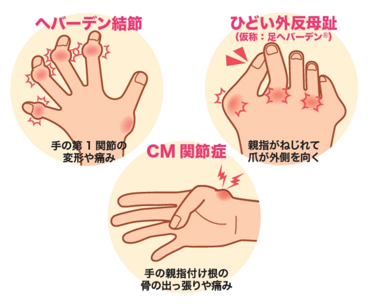 �O������@3/7(�y)